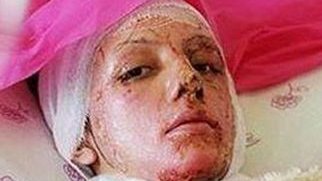 چرا اشرف غنی، اسید پاشی های اصفهان را محکوم نکرد؟