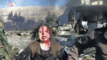 کسانی که کشتار دسته دسته ی مردم را در نقاط مختلف افغانستان به شمول ارگون موجب می شوند!