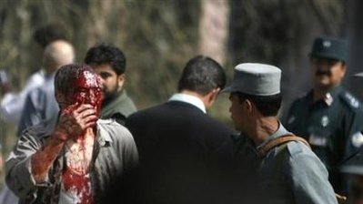 صحنه های خونین انفجار دوشنبه از چشم دوربین