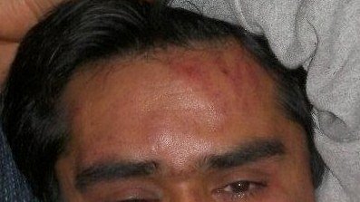 حمله گسترده فاشیست های یونان بالای پناهجویان افغانستان چهار زخمی به جا گذاشت