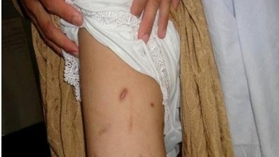 هشتم مارچ روز جهانی زن و ادامه خشونت علیه زنان