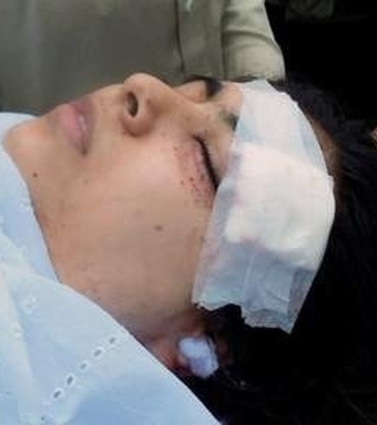 سؤقصد علیه ملالی یوسفزی لکۀ ننگی برجبین ارتجاع اسلامی