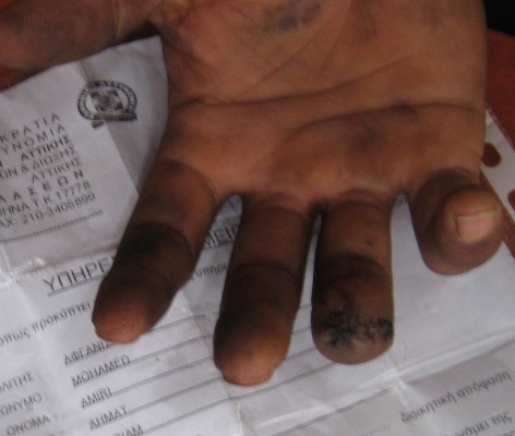 Greek: Homeless and Human Rights Abuse