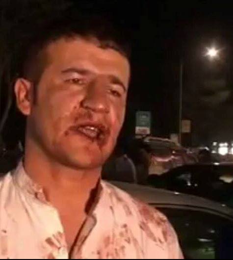 لت و کوب یک خبرنگار توسط بصیر سالنگی