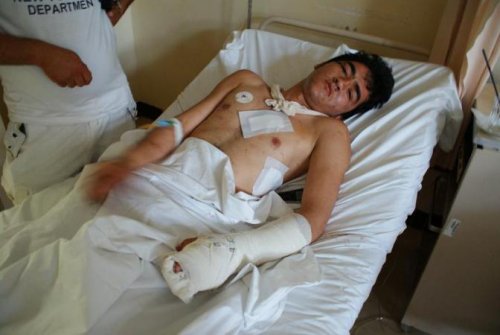 Afghan Refugees attacked by "Nazi Skins" gang in Athens 